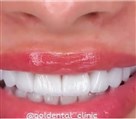 کلینیک تخصصی دندانپزشکی گلدنتال - تصویر 140
