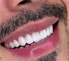 156