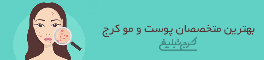 متخصص پوست و مو تهران